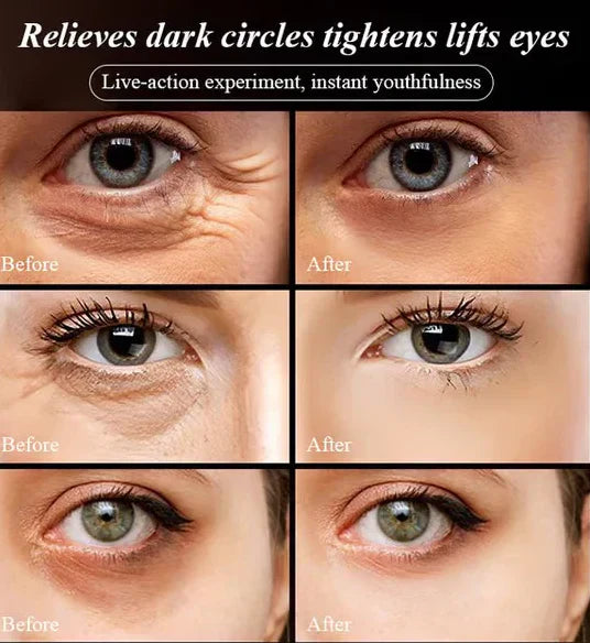 Last Day Of Discount š„ Anti Aging Eye Cream š§